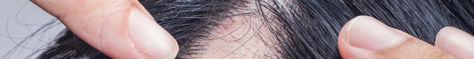 La culture de cheveux en laboratoire : un espoir pour ceux qui souffrent d’alopécie
