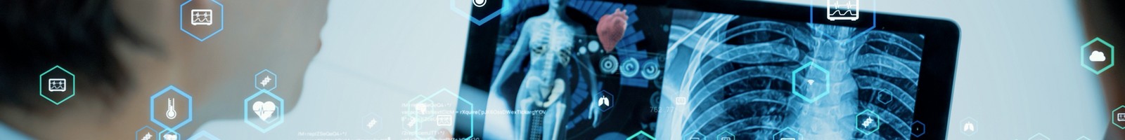 IRM accessible à tous : une révolution technologique dopée par l’intelligence artificielle