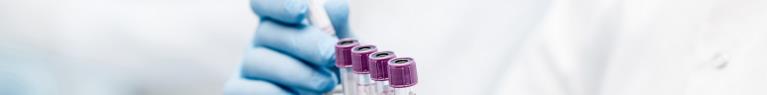 Test de sensibilité aux antibiotiques : bioMérieux acquiert Specific Diagnostics