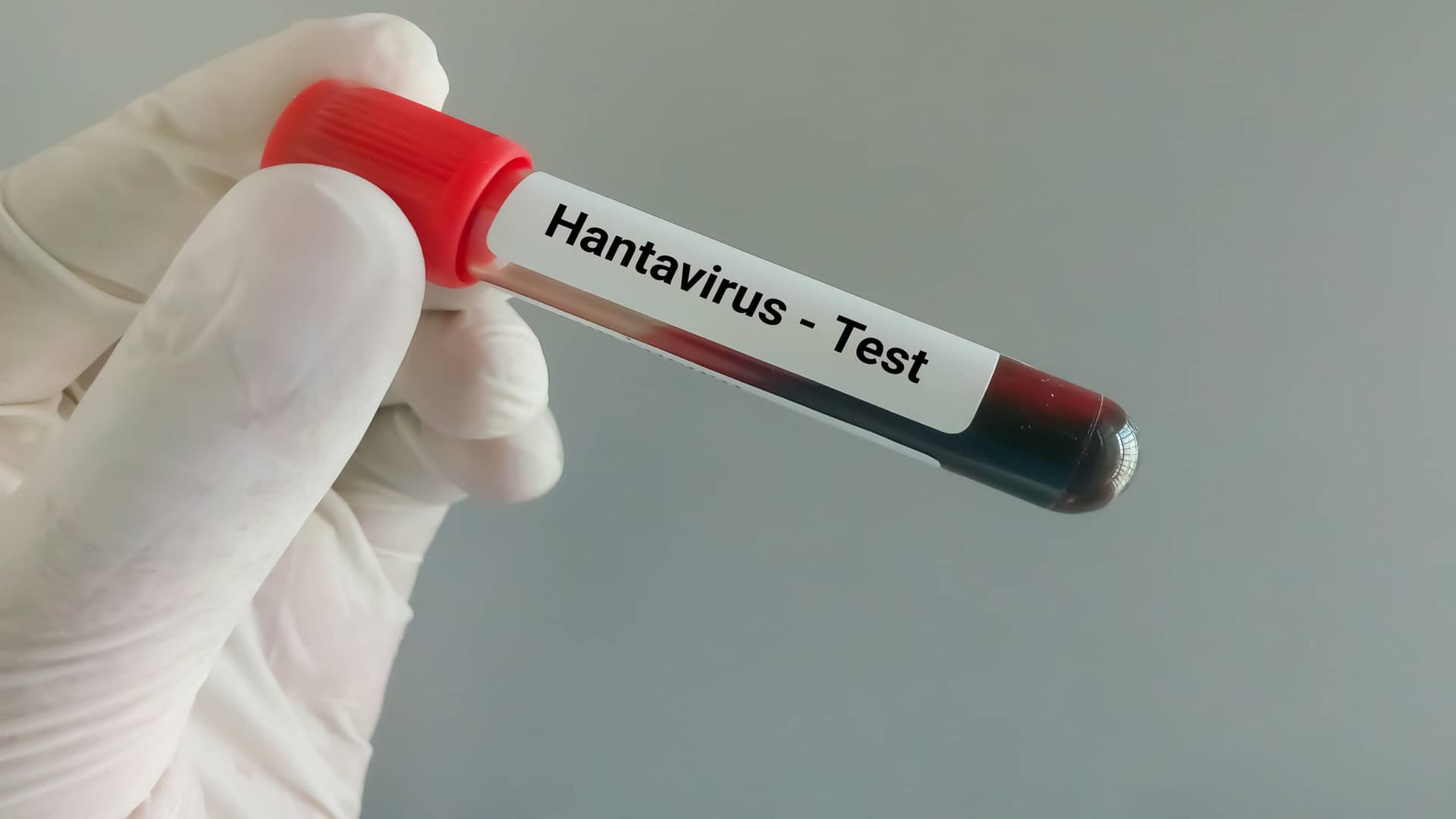 Les cas d’infection à hantavirus du paquebot MV Hondius incitent à la prudence