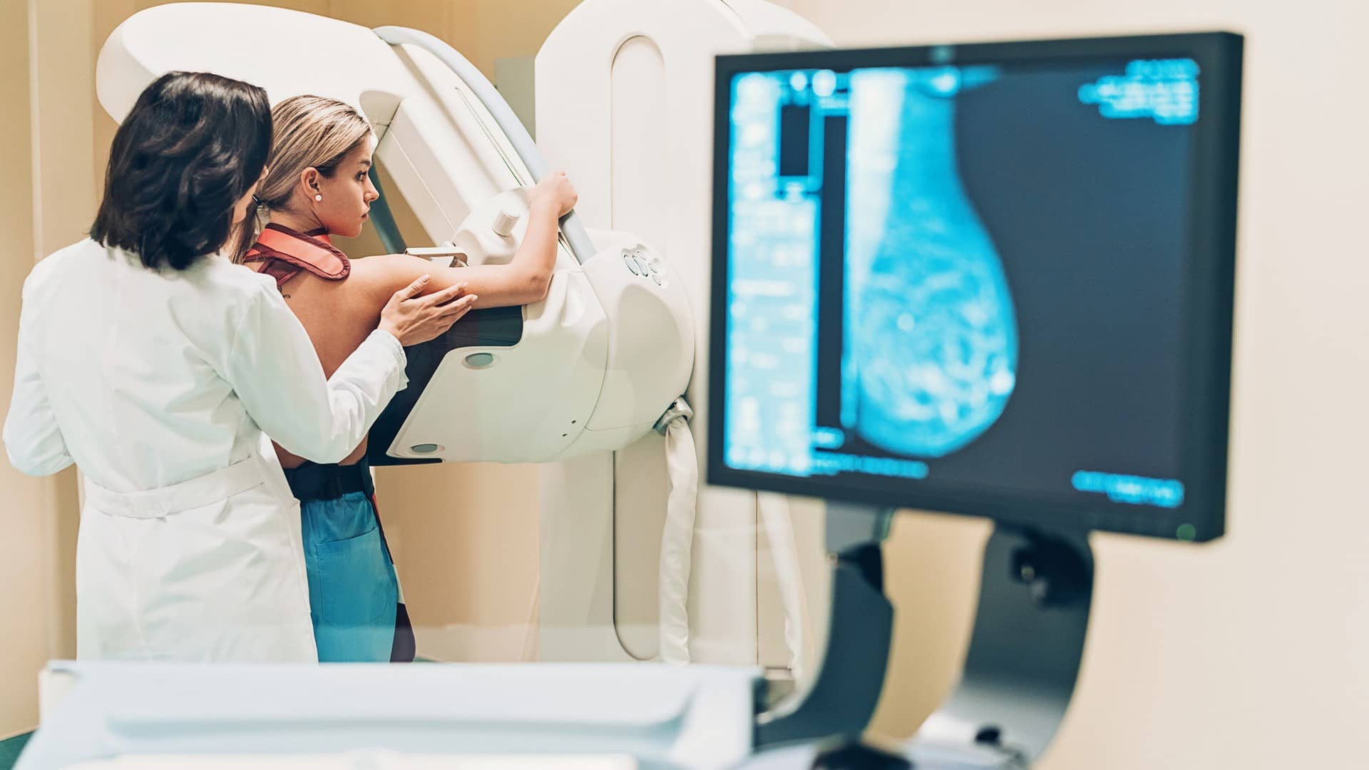 La Cour des comptes soulève des failles dans la prise en charge du cancer du sein