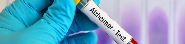 La détection de protéines bêta amyloïdes dans le sang n’induit pas forcément l’apparition de l’Alzheimer