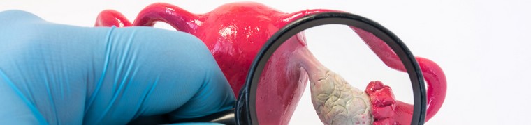 Des scientifiques québécoises cherchent un traitement contre le cancer de l’ovaire